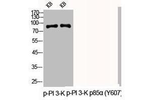 Western Blot analysis of KB cells using Phospho-PI 3-kinase p85α (Y607) Polyclonal Antibody (PIK3R1 antibody  (pTyr607))