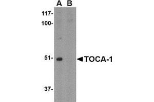 Western blot analysis of TOCA-1 in mouse brain tissue lysate with in (A) the absence and (B) the presence of blocking peptide with this product at 1 μg/ml. (FNBP1L antibody  (C-Term))