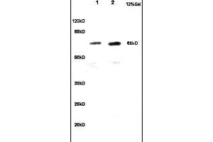 Lane 1: rat brain lysates Lane 2: mouse embryo lysates probed with Anti CKAP4 Polyclonal Antibody, Unconjugated  at 1:200 in 4˚C. (CKAP4 antibody  (AA 525-602))