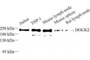 Western blot analysis of DOCK2 (ABIN7073706) at dilution of 1: 500 (DOCK2 antibody)