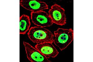 Fluorescent confocal image of  cell stained with EWSR1 Antibody (C-term) (ABIN652770 and ABIN2842507). (EWSR1 antibody  (C-Term))