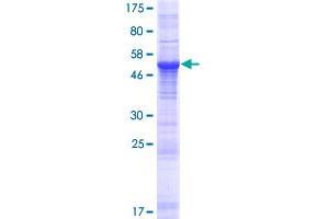 RFXANK Protein (AA 1-237) (GST tag)