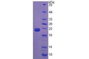 SDS-PAGE (SDS) image for Calreticulin (CALR) (AA 18-193) protein (His tag) (ABIN1169991)