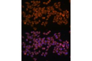 Immunofluorescence (IF) image for anti-Fatty Acid Synthase (FASN) antibody (ABIN7267157)