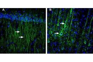 Expression of creatine transporter in rat hippocampus and cortex - Immunohistochemical staining of perfusion-fixed frozen rat brain sections with Anti-SLC6A8 Antibody (ABIN7043739, ABIN7044471 and ABIN7044472), (1:200), followed by goat anti-rabbit-AlexaFluor-488. (SLC6A8 antibody  (C-Term, Extracellular))