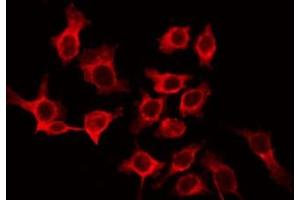 ABIN6266513 staining LOVO by IF/ICC. (CLDN10 antibody  (C-Term))