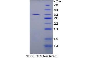 SDS-PAGE analysis of Mouse LOX1 Protein.