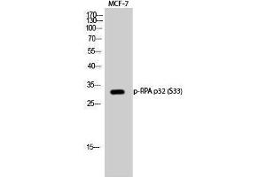 Western Blotting (WB) image for anti-Replication Protein A2, 32kDa (RPA2) (pSer33) antibody (ABIN3182369) (RPA2 antibody  (pSer33))