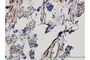 Immunoperoxidase of monoclonal antibody to DKK1 on formalin-fixed paraffin-embedded human placenta. (DKK1 antibody  (AA 1-266))