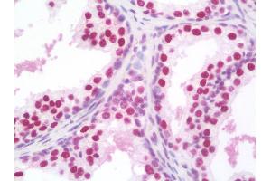 Anti-SSB / La antibody IHC staining of human prostate. (SSB antibody)