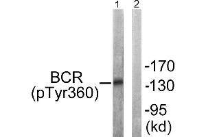 Immunohistochemistry analysis of paraffin-embedded human brain tissue using Bcr (Phospho-Tyr360) antibody. (BCR antibody  (pTyr360))