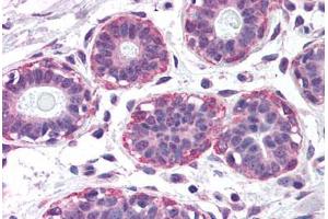 Human Breast (formalin-fixed, paraffin-embedded) stained with NET1 antibody ABIN299308 at 2. (NET1 antibody  (AA 396-409))