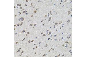 Immunohistochemistry (Paraffin-embedded Sections) (IHC (p)) image for anti-Forkhead Box O3 (FOXO3) (AA 394-672) antibody (ABIN6140755)