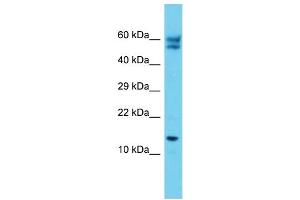 Host: Rabbit Target Name: C12orf65 Sample Type: Jurkat Whole Cell lysates Antibody Dilution: 1. (C12orf65 antibody  (C-Term))
