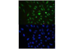 IF analysis of HP1 gamma using anti-HP1 gamma antibody (ABIN5693033). (CBX3 antibody  (AA 2-183))