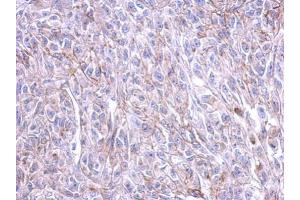 IHC-P Image Immunohistochemical analysis of paraffin-embedded HeLa xenograft, using CRFR1, antibody at 1:500 dilution. (CRHR1 antibody  (N-Term))