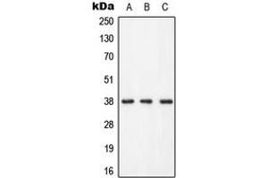 Western blot analysis of LAT (pY255) expression in HEK293T (A), Raw264. (LAT antibody  (C-Term, pTyr255))