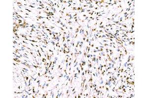 IHC analysis of Giantin/GOLGB1 using anti-Giantin/GOLGB1 antibody (ABIN7600139). (Golgin B1 (GOLGB1) (AA 153-950) antibody)
