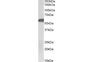 ABIN5539774 (1µg/ml) staining of Human Hippocampus lysate (35µg protein in RIPA buffer). (GLP1R antibody  (Internal Region))