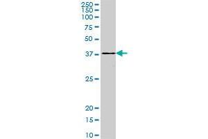 DEGS1 monoclonal antibody (M01A), clone 3F9. (DEGS1 antibody  (AA 226-323))