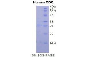 SDS-PAGE (SDS) image for Ornithine Decarboxylase 1 (ODC1) (AA 234-453) protein (His tag) (ABIN2121800)