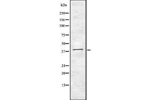 Western blot analysis of MNX1 using LOVO whole  lysates. (MNX1 antibody  (C-Term))