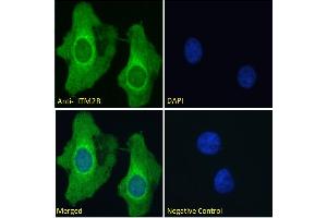 Immunofluorescence (IF) image for anti-Integral Membrane Protein 2B (ITM2B) (Internal Region) antibody (ABIN570955)