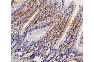 IHC analysis of Collagen III/COL3A1 using anti-Collagen III/COL3A1 antibody (ABIN6719296).