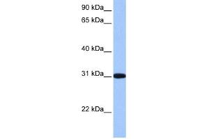 WB Suggested Anti-RFPL2 Antibody Titration: 0. (RFPL2 antibody  (C-Term))