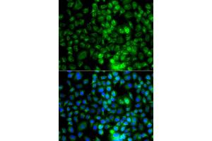 Immunofluorescence analysis of A549 cells using EPHA1 antibody (ABIN6290349).