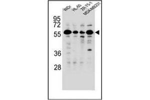 Western blot analysis of FOXC2 Antibody  in WiDr,HL-60,ZR-75-1,MDA-MB231 cell line lysates (35ug/lane). (FOXC2 antibody  (Middle Region))