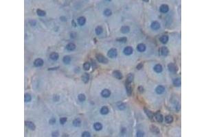 IHC-P analysis of Human Tissue, with DAB staining. (HLA-E antibody  (AA 136-350))