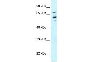 Western Blot showing TOMM70A antibody used at a concentration of 1 ug/ml against Hela Cell Lysate