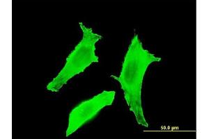Immunofluorescence of monoclonal antibody to BTLA on HeLa cell. (BTLA antibody  (AA 190-289))