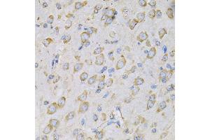 Immunohistochemistry of paraffin-embedded rat brain using IL10RA Antibody (ABIN5970931) at dilution of 1/100 (40x lens).