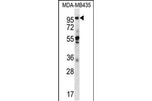 Western blot analysis in MDA-MB435 cell line lysates (35ug/lane). (MIA2 antibody  (C-Term))