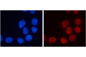 Immunofluorescence analysis of 293T cells using TriMethyl-Histone H3-K4 Polyclonal Antibody (Histone 3 antibody  (3meLys4))