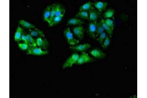 Immunofluorescent analysis of HepG2 cells using ABIN7153418 at dilution of 1:100 and Alexa Fluor 488-congugated AffiniPure Goat Anti-Rabbit IgG(H+L) (GALK1 antibody  (AA 23-164))