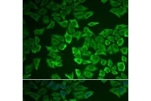 Immunofluorescence analysis of HeLa cells using CRHBP Polyclonal Antibody (CRHBP antibody)