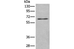 Western blot analysis of SKOV3 cell lysate using UBQLN2 Polyclonal Antibody at dilution of 1:500 (Ubiquilin 2 antibody)