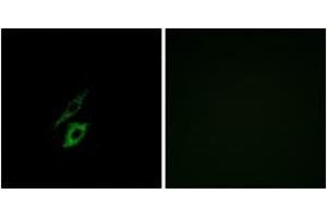 Immunofluorescence analysis of A549 cells, using FPR1 Antibody. (FPR1 antibody  (AA 151-200))