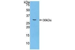 Detection of Recombinant CA125, Mouse using Polyclonal Antibody to Carbohydrate Antigen 125 (CA125) (MUC16 antibody  (AA 2-258))
