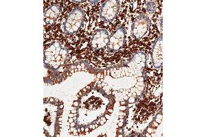 Immunohistochemical analysis of paraffin-embedded Human small intestine tissue using A performed on the Leica® BOND RXm. (Vimentin antibody)