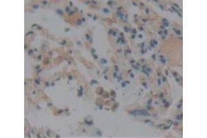 Used in DAB staining on fromalin fixed paraffin- embedded lung tissue (CNN2 antibody  (AA 1-269))