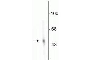 Western blot of rat adrenal medulla showing specific immunolabeling of the ~55 kDa DDC protein. (DDC antibody)