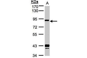 Western Blotting (WB) image for anti-Adrenergic, Beta, Receptor Kinase 1 (ADRBK1) (C-Term) antibody (ABIN2855125)