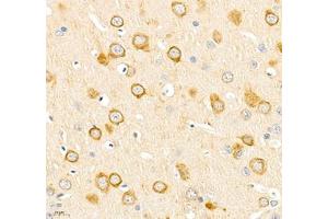 Immunohistochemistry of paraffin embedded rat brain using IP3R1 (ABIN7074293) at dilution of 1: 2400 (400x lens) (IP3 Receptor antibody)