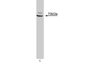 Western Blotting (WB) image for anti-zeta-Chain (TCR) Associated Protein Kinase 70kDa (ZAP70) (AA 468-619) antibody (ABIN967849) (ZAP70 antibody  (AA 468-619))