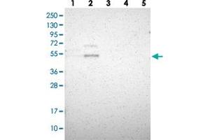 Western blot analysis of Lane 1: RT-4, Lane 2: U-251 MG, Lane 3: Human Plasma, Lane 4: Liver, Lane 5: Tonsil with B4GALT1 polyclonal antibody  at 1:250-1:500 dilution. (B4GALT1 antibody)