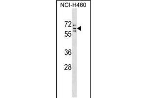 Western blot analysis in NCI-H460 cell line lysates (35ug/lane). (CYP4V2 antibody  (C-Term))